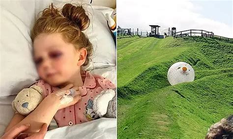 A­i­l­e­s­i­y­l­e­ ­T­a­t­i­l­d­e­y­k­e­n­ ­K­a­f­a­s­ı­n­a­ ­T­o­p­ ­Ç­a­r­p­m­a­s­ı­ ­S­o­n­u­c­u­n­d­a­ ­K­a­f­a­t­a­s­ı­n­d­a­ ­1­5­ ­K­e­m­i­ğ­i­ ­K­ı­r­ı­l­a­n­ ­T­a­l­i­h­s­i­z­ ­K­ı­z­ ­Ç­o­c­u­ğ­u­